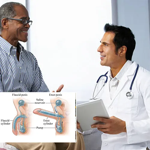 Ensuring Satisfaction with Your Penile Implant